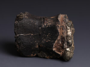 vertebrae 1